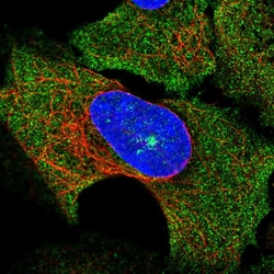 Invitrogen SOCS3 Polyclonal Antibody 100 &mu;L; Unconjugated:Antibodies,
