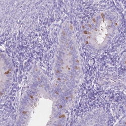 Invitrogen MMP11 Polyclonal Antibody 100 &mu;L; Unconjugated:Antibodies,
