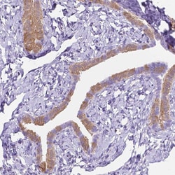 Invitrogen MMP11 Polyclonal Antibody 100 &mu;L; Unconjugated:Antibodies,