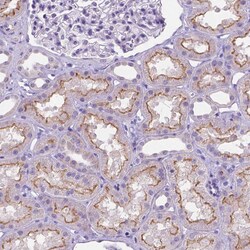 Invitrogen MMP11 Polyclonal Antibody 100 &mu;L; Unconjugated:Antibodies,