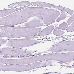 Invitrogen MMP11 Polyclonal Antibody 100 &mu;L; Unconjugated:Antibodies,