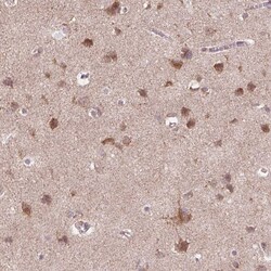 Invitrogen FZD7 Polyclonal Antibody 100 μL; Unconjugated:Antibodies,