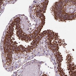 Invitrogen FZD7 Polyclonal Antibody 100 μL; Unconjugated:Antibodies,