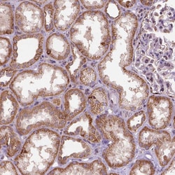 Invitrogen FZD7 Polyclonal Antibody 100 μL; Unconjugated:Antibodies,