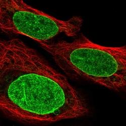 Invitrogen GTF3C3 Polyclonal Antibody 100 μL; Unconjugated:Antibodies,