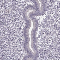 Invitrogen FSH beta Polyclonal Antibody 100 &mu;L; Unconjugated:Antibodies,
