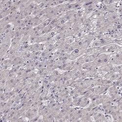 Invitrogen FSH beta Polyclonal Antibody 100 &mu;L; Unconjugated:Antibodies,
