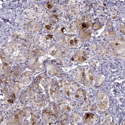 Invitrogen FSH beta Polyclonal Antibody 100 &mu;L; Unconjugated:Antibodies,