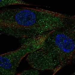 Invitrogen ACE Polyclonal Antibody 100 &mu;L; Unconjugated:Antibodies,