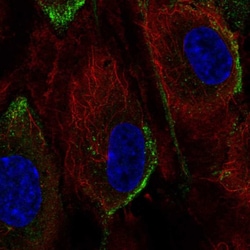 Invitrogen PIK3CG Polyclonal Antibody 100 &mu;L; Unconjugated:Antibodies,