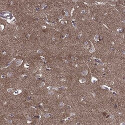 Invitrogen TAB2 Polyclonal Antibody 100 &mu;L; Unconjugated:Antibodies,