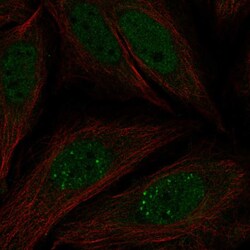 Invitrogen MKNK2 Polyclonal Antibody 100 μL; Unconjugated:Antibodies,