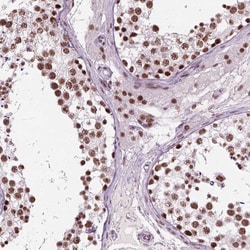 Invitrogen GTF2F1 Polyclonal Antibody:Antibodies:Primary Antibodies