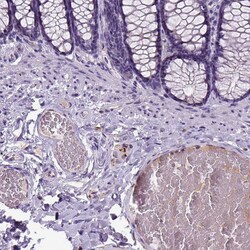 Invitrogen Dopamine beta Hydroxylase Polyclonal Antibody:Antibodies:Primary