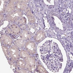 Invitrogen Dopamine beta Hydroxylase Polyclonal Antibody:Antibodies:Primary