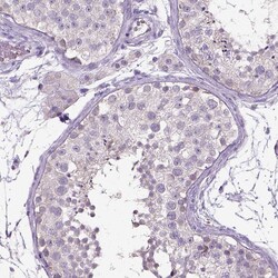 Invitrogen Dopamine beta Hydroxylase Polyclonal Antibody:Antibodies:Primary