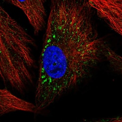 Invitrogen MMP19 Polyclonal Antibody 100 μL; Unconjugated:Antibodies,