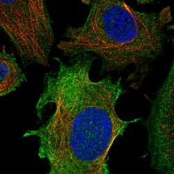 Invitrogen ULBP1 Polyclonal Antibody 100 &mu;L; Unconjugated:Antibodies,