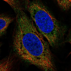 Invitrogen USP15 Polyclonal Antibody:Antibodies:Primary Antibodies