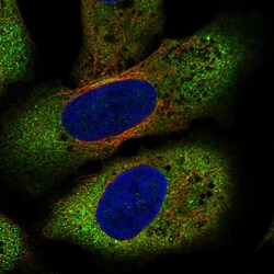 Invitrogen FZD8 Polyclonal Antibody 100 &mu;L; Unconjugated:Antibodies,