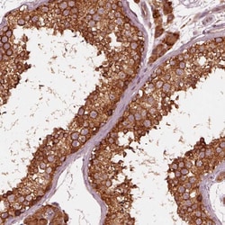 Invitrogen ETEA Polyclonal Antibody:Antibodies:Primary Antibodies