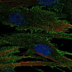 Invitrogen RECK Polyclonal Antibody 100 &mu;L | Buy Online | Invitrogen&trade; | Fisher Scientific