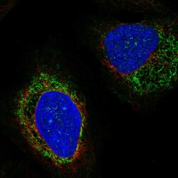 Invitrogen STEP Polyclonal Antibody 100 &mu;L; Unconjugated:Antibodies,