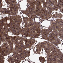 Invitrogen FBXW11 Polyclonal Antibody 100 μL; Unconjugated:Antibodies,