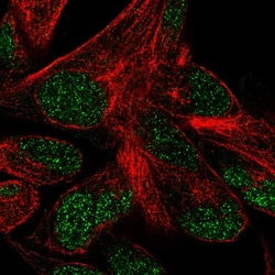 Invitrogen POLR3F Polyclonal Antibody 100 μL; Unconjugated:Antibodies,