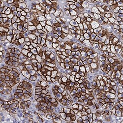 Invitrogen SR-BI Polyclonal Antibody 100 &mu;L; Unconjugated:Antibodies,