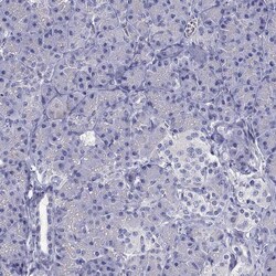 Invitrogen SR-BI Polyclonal Antibody 100 &mu;L; Unconjugated:Antibodies,