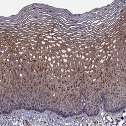 Invitrogen TRIP10 Polyclonal Antibody 100 &mu;L; Unconjugated:Antibodies,