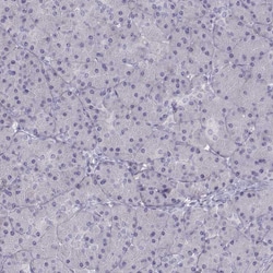 Invitrogen TBX19 Polyclonal Antibody 100 &mu;L | Buy Online | Invitrogen&trade; | Fisher Scientific