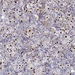 Invitrogen TBX19 Polyclonal Antibody 100 &mu;L | Buy Online | Invitrogen&trade; | Fisher Scientific