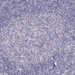 Invitrogen TBX19 Polyclonal Antibody 100 &mu;L | Buy Online | Invitrogen&trade; | Fisher Scientific