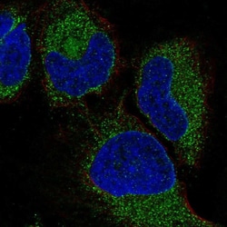 Invitrogen VIP Polyclonal Antibody 100 μL; Unconjugated:Antibodies,