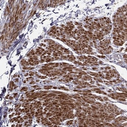Invitrogen TRIP10 Polyclonal Antibody 100 &mu;L; Unconjugated:Antibodies,