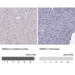 Invitrogen GRIK4 Polyclonal Antibody 100 &mu;L; Unconjugated:Antibodies,