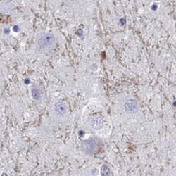 Invitrogen GRIK4 Polyclonal Antibody 100 &mu;L; Unconjugated:Antibodies,