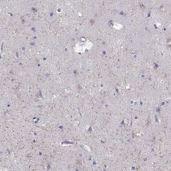 Invitrogen GRIK4 Polyclonal Antibody 100 &mu;L; Unconjugated:Antibodies,
