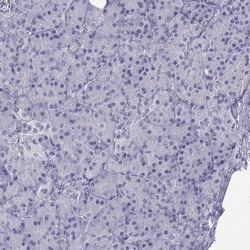 Invitrogen GRIK4 Polyclonal Antibody 100 &mu;L; Unconjugated:Antibodies,