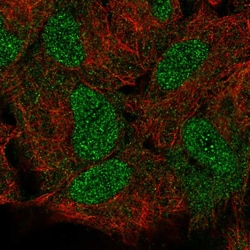 Invitrogen HOXB5 Polyclonal Antibody:Antibodies:Primary Antibodies