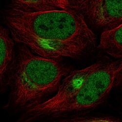 Invitrogen ZNF131 Polyclonal Antibody:Antibodies:Primary Antibodies