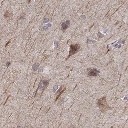 Invitrogen PLEKHG3 Polyclonal Antibody 100 μL; Unconjugated:Antibodies,