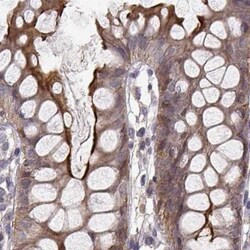 Invitrogen PLEKHG3 Polyclonal Antibody 100 μL; Unconjugated:Antibodies,