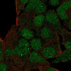 Invitrogen GSC Polyclonal Antibody 100 &mu;L; Unconjugated:Antibodies,