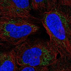 Invitrogen ARHGAP20 Polyclonal Antibody 100 &mu;L; Unconjugated:Antibodies,