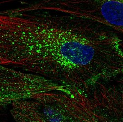 Invitrogen CHIC2 Polyclonal Antibody:Antibodies:Primary Antibodies