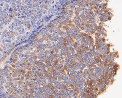 Invitrogen Follicle Stimulating Hormone Polyclonal Antibody 100 &mu;L;