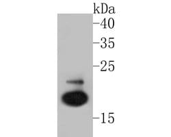 Invitrogen Follicle Stimulating Hormone Polyclonal Antibody 100 &mu;L;